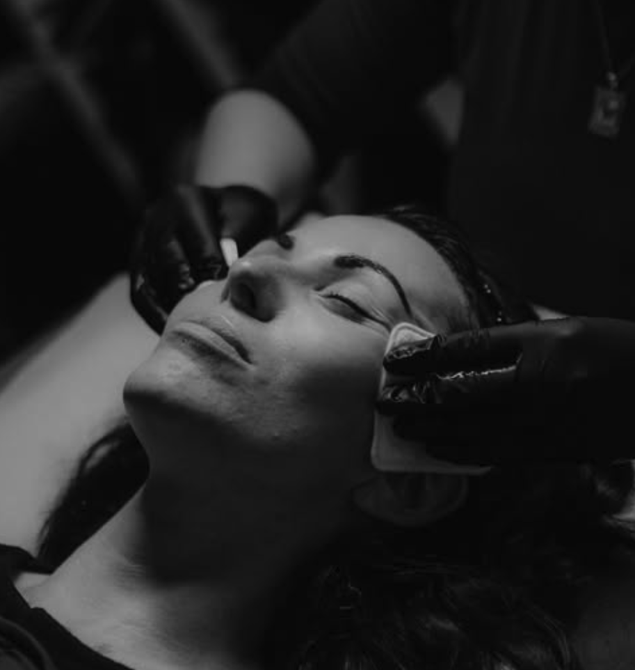 skin treatment with skinbooster and chemical peel